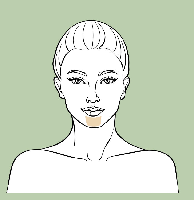 Chin (Mentón) Laser Hair Removal